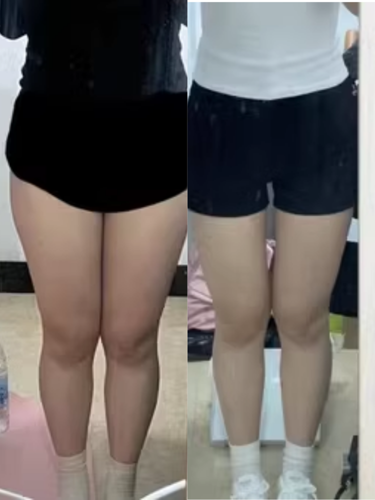 Before and after