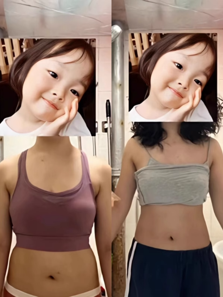 Before and after